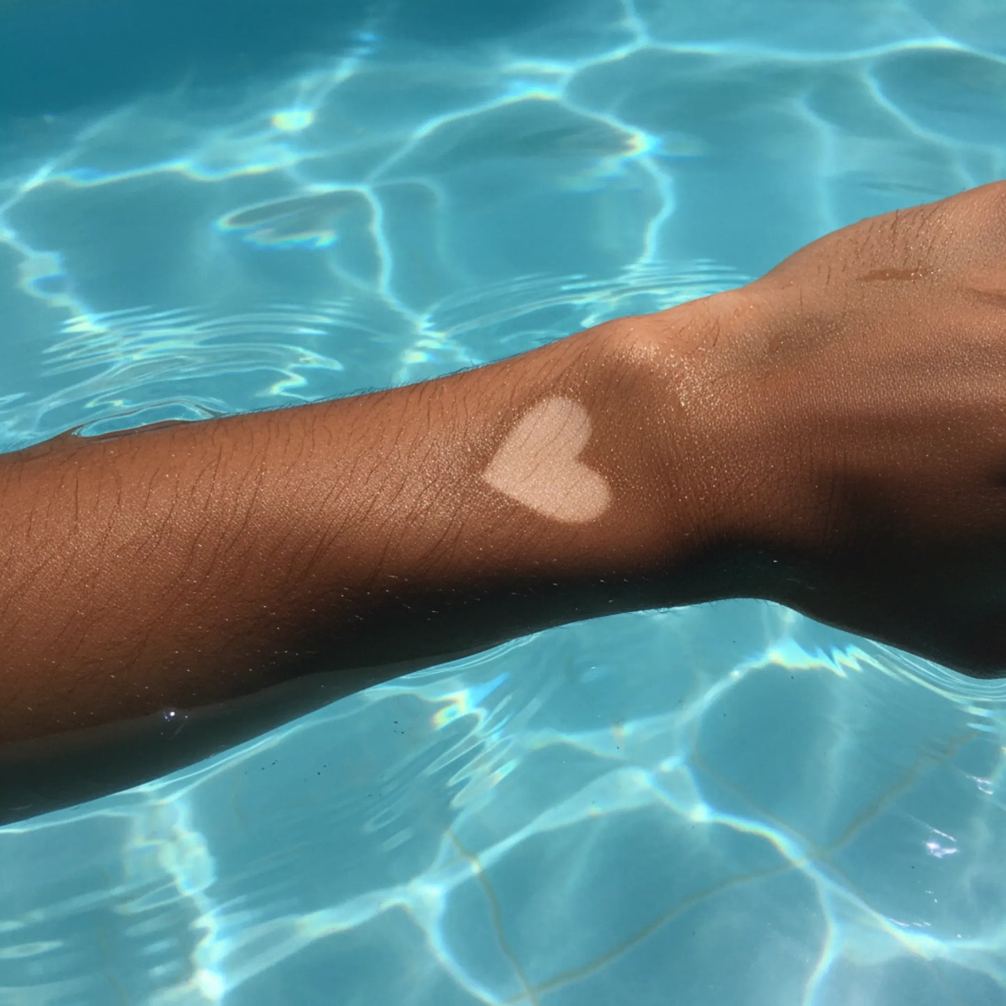 Heart-shaped birthmark on a person's arm with clear blue water in the background